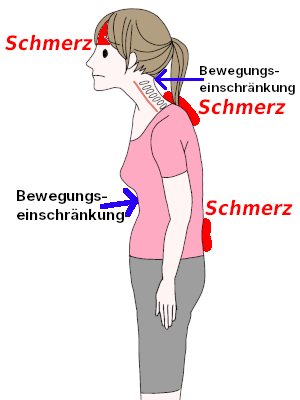Bewegungseinschränkungen und Schmerzen [Bewegungseinschränkungen und Schmerzen