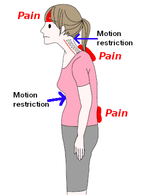 Motion restrictions and pain [Motion restrictions and pain